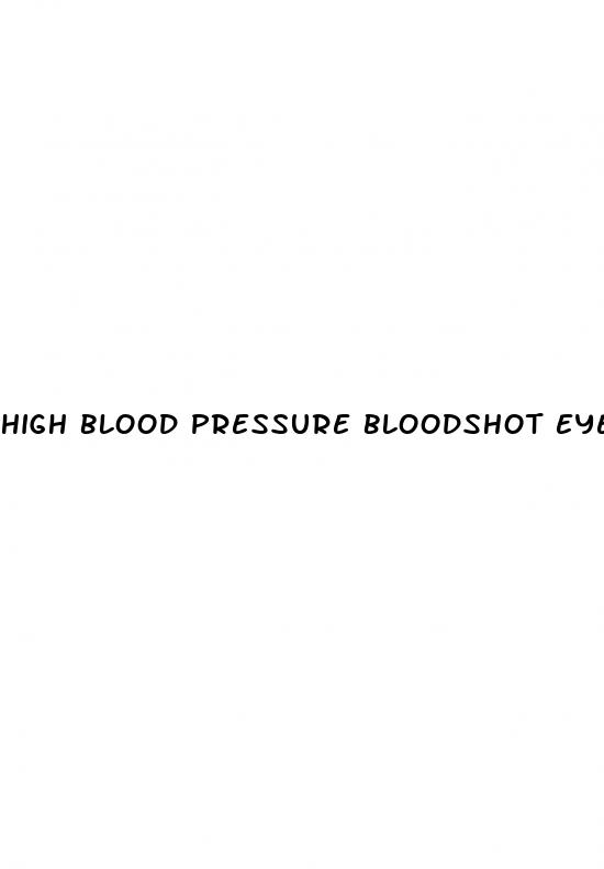 high blood pressure bloodshot eyes