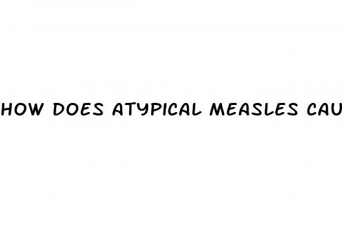 how does atypical measles cause hypertension