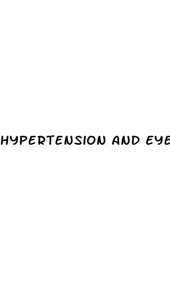 hypertension and eye floaters