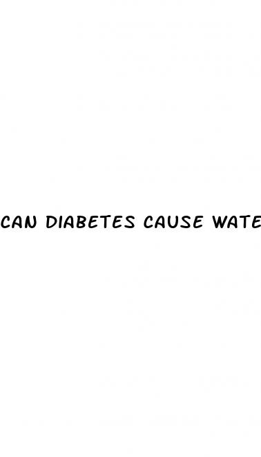 can diabetes cause watery eyes