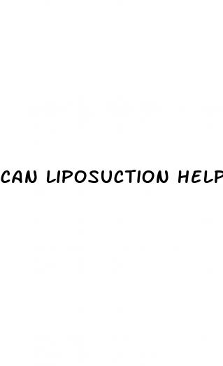 can liposuction help with type 2 diabetes