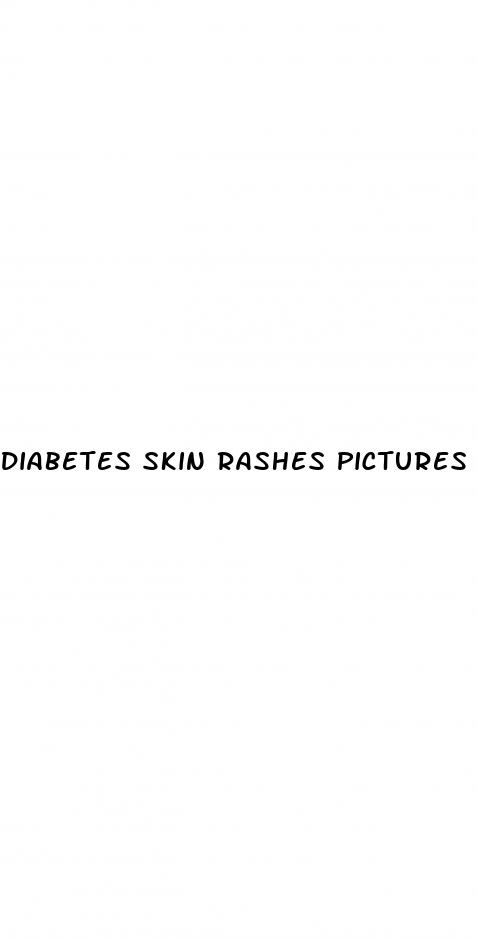 diabetes skin rashes pictures