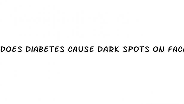 does diabetes cause dark spots on face