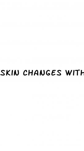skin changes with diabetes