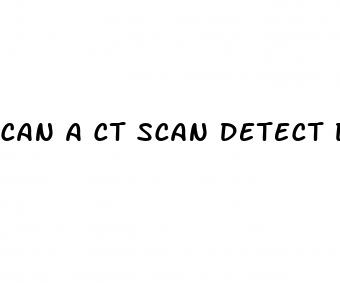 can a ct scan detect diabetes